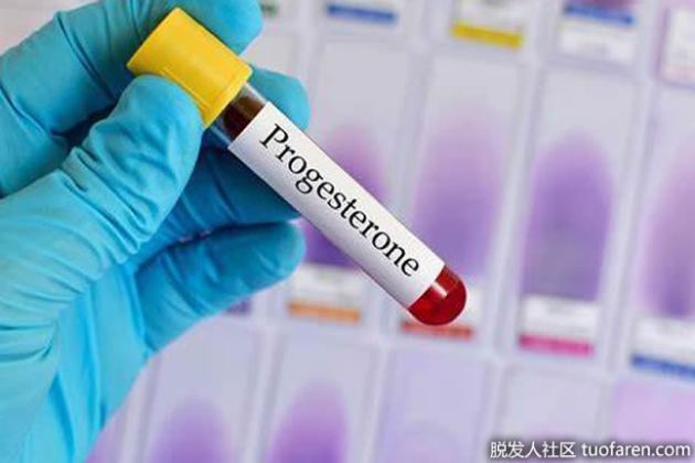 【圖】黃體酮水平低的原因