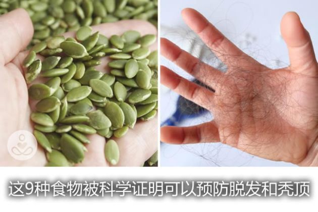 【圖】這9種食物被科學證明可以預防脱髮和禿頂