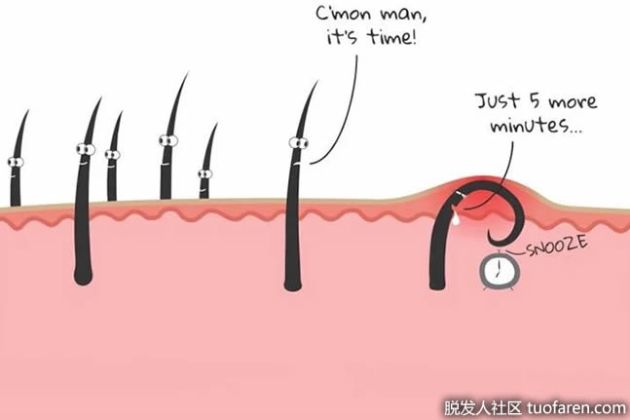 【圖】如何治療向內生長的眉毛？