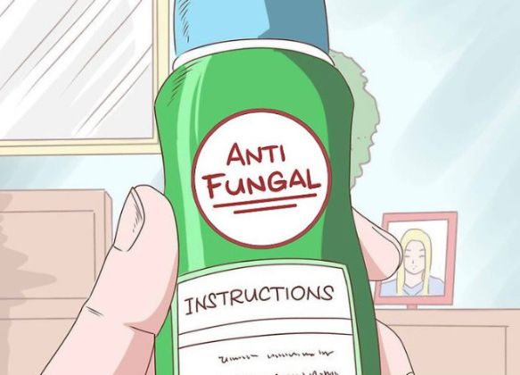 【圖】抗真菌洗髮水的種類