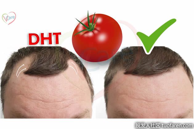 【圖】減少二氫睾酮水平的食物