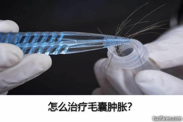 【圖】毛囊檢測有多精確？