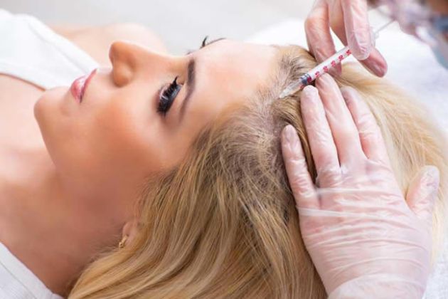 【圖】PRP（富血小板血漿）治療對脱髮有效嗎?