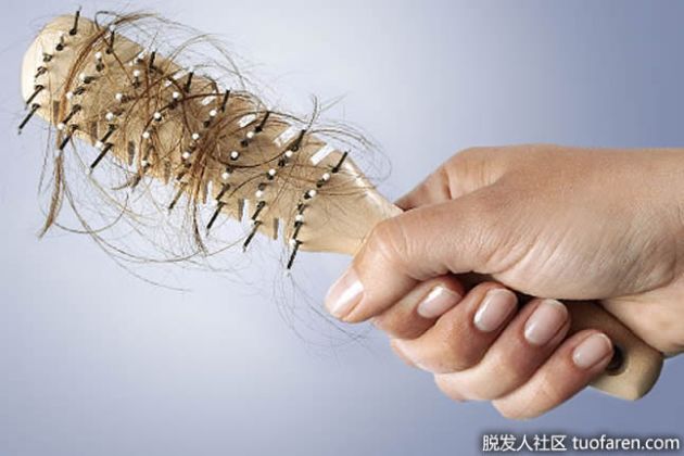 【圖】通過營養預防女性脱髮