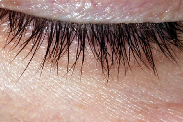 【圖】睫毛脱落的原因