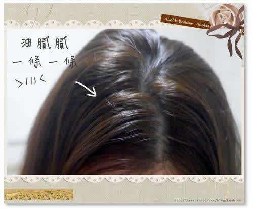 【圖】頭髮出油多少是正常的?如何有效控制出油