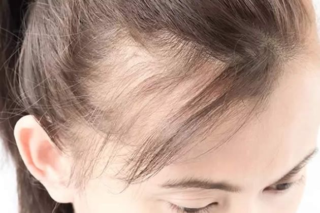 【圖】抗氧化劑促進頭髮生長嗎？