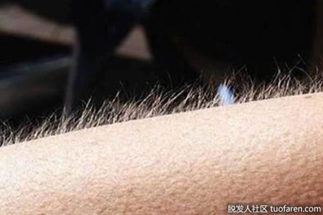 【圖】【組圖】立毛肌的功能是什麼？