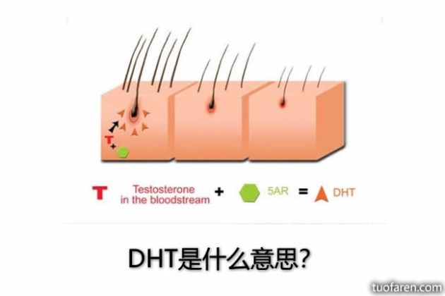 【圖】DHT是什麼意思？