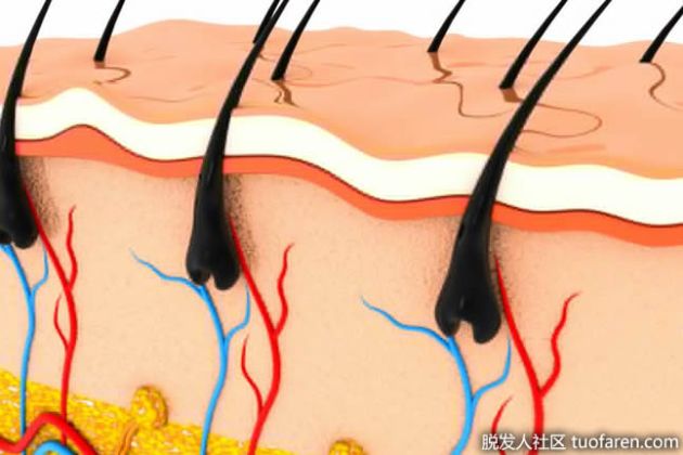 【圖】為什麼有些毛囊是黑色的？