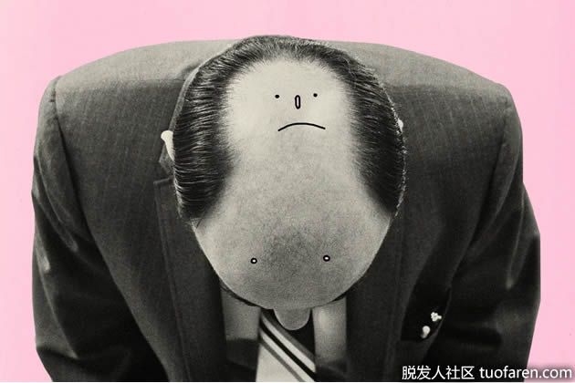 【圖】什麼是脱髮？