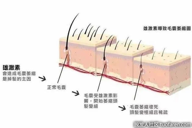 【圖】DHT(二氫睾酮)是什麼？