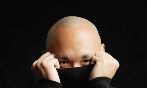 【圖】頭髮脱髮什麼原因？