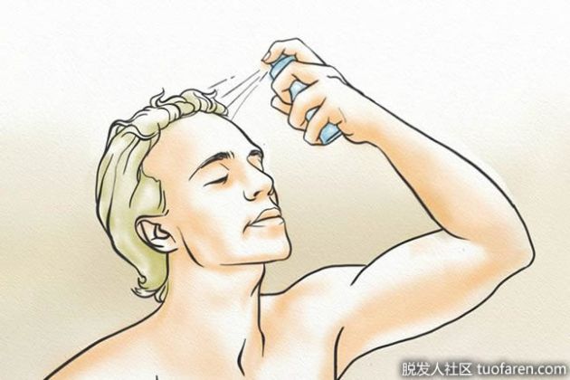 【圖】米諾地爾溶液可能的副作用