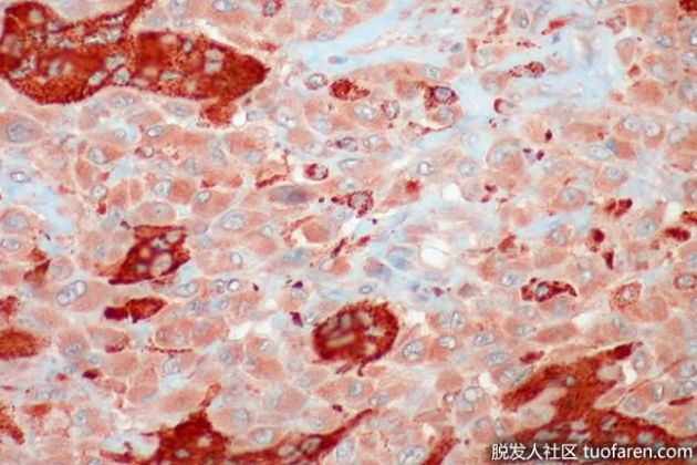 【圖】為什麼肌肉細胞有多個細胞核？