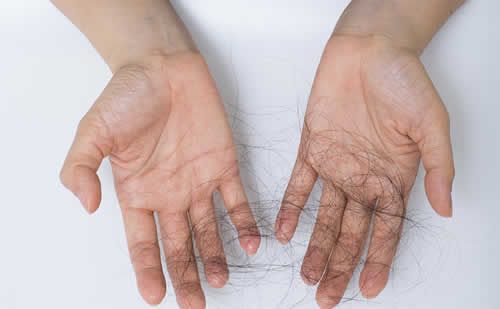 【圖】身體壓力大脱髮的治療方法