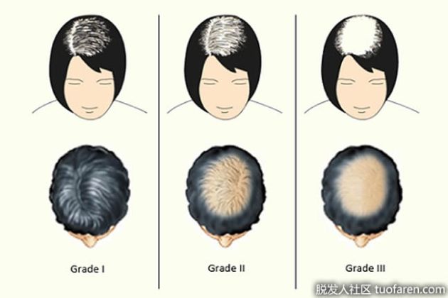 【圖】毛囊的生長規律及週期