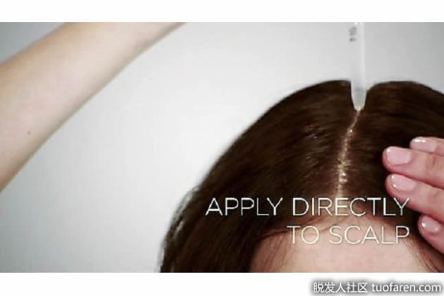 【圖】女性使用落健5%米諾地爾的影響