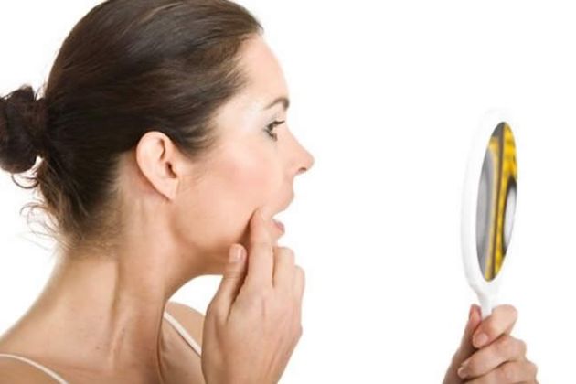 【圖】是什麼引起女性面部毛髮？