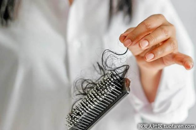 【圖】缺鐵脱髮 如何讓頭髮重新生長