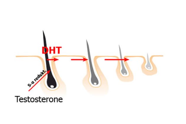 【圖】什麼是DHT？