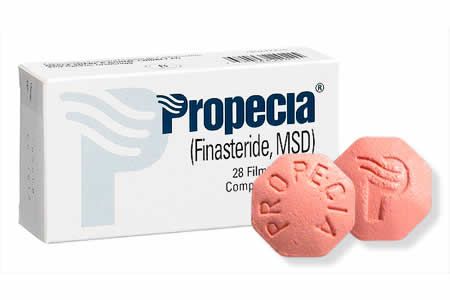 【圖】非那雄胺治療脱髮的效果如何