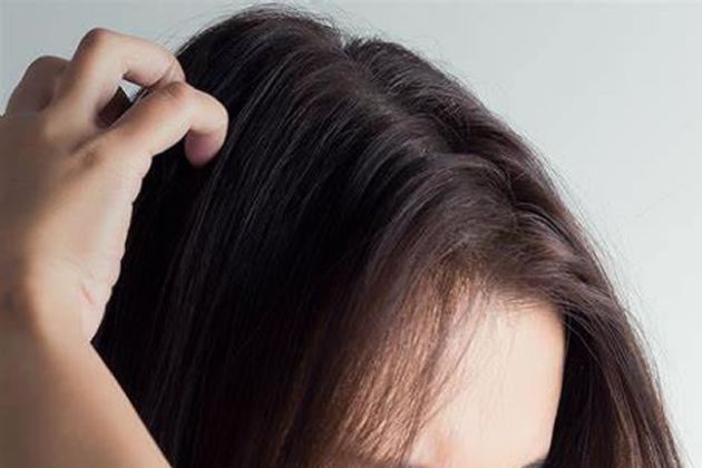 【圖】是什麼引起頭皮水皰？