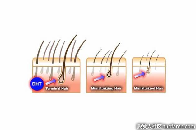 【圖】身體dht是什麼