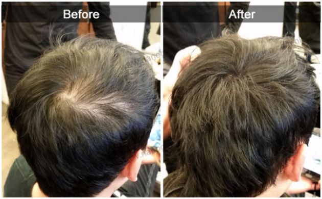 【圖】如何遮蓋禿頂