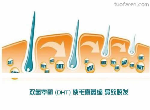 【圖】雙氫睾酮DHT是什麼 雙氫睾酮DHT治療藥物