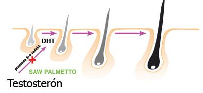 【圖】鋸棕櫚和DHT之間有什麼聯繫？