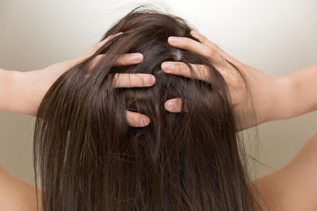 【圖】什麼原因導致頭皮鱗屑？