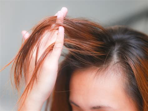 【圖】如何刺激毛囊並自然刺激新的頭髮生長