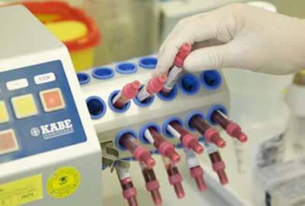 【圖】血液測試能幫助發現脱髮的原因嗎?