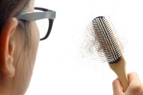 【圖】什麼原因導致產後脱髮 什麼時候停止?