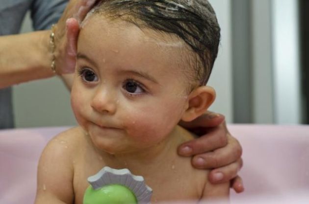 【圖】什麼導致兒童頭皮屑？