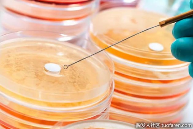 【圖】葡萄球菌感染會傳染嗎？