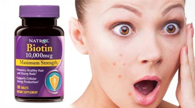 【圖】生物素和痤瘡有什麼關係?