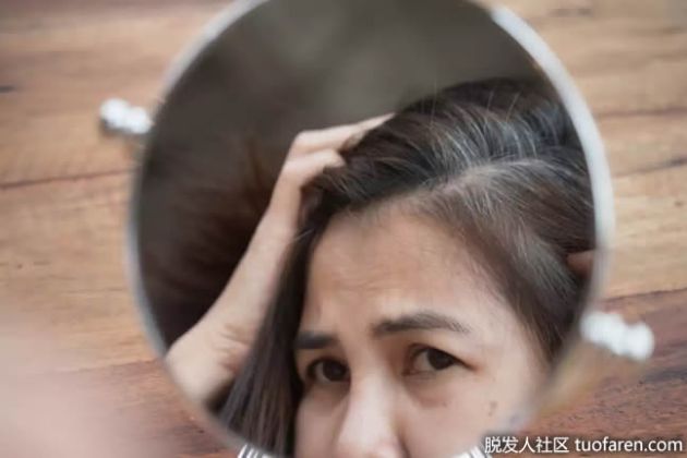【圖】是什麼導致了白頭髮？