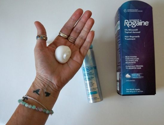 【圖】什麼是外用米諾地爾？