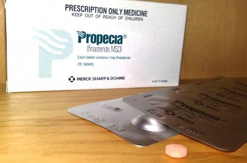 【圖】保法止還是保列治最適合治脱髮