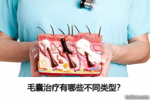 【圖】毛囊治療有哪些不同類型？