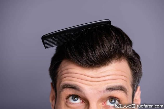 【圖】購買米諾地爾時要考慮的5件事