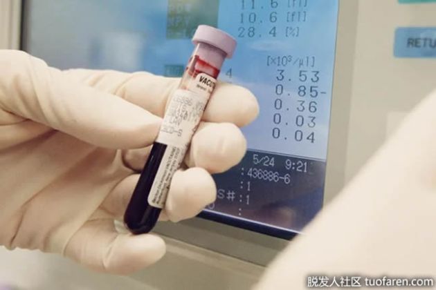 【圖】 什麼導致維生素b12指標高 ？