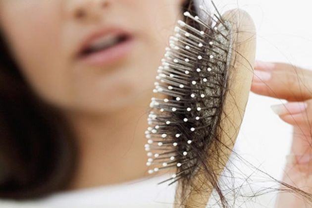 【圖】你的荷爾蒙會導致脱髮嗎?
