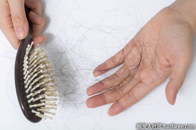 【圖】如何判斷自己是否脱髮？