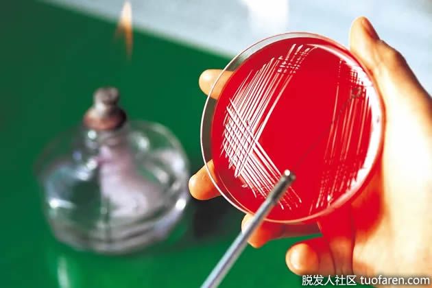 【圖】益生菌過量