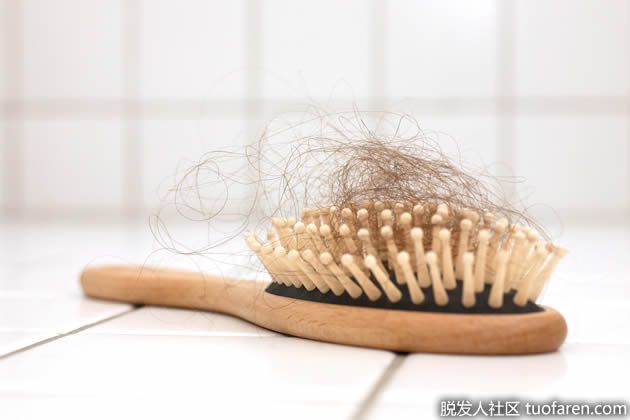 【圖】缺鐵會掉頭髮嗎？
