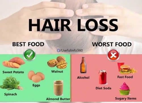 【圖】防止脱髮的飲食有哪些