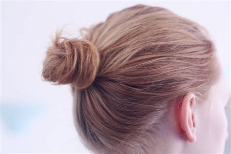 【圖】如何逆轉牽引性脱髮